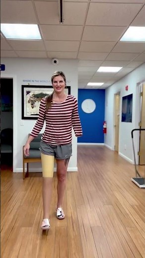Miranda: Above-Knee & Shoulder Disarticulate Amputee Prosthetic Progress!