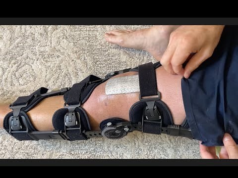 Quadriceps Tendon Rupture Recovery - Week 1