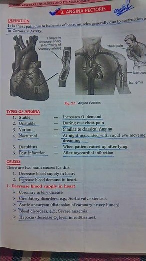👉 “Angina Pectoris Explained | Symptoms, Types & Treatment | Nursing Exam 2026”#gnm #anm