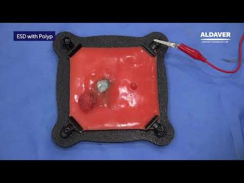 ESD Training Model with Polyp - ALDAVER Surgical Simulators