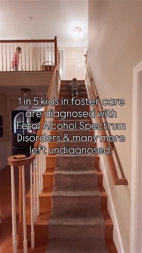Jamie Finn on Instagram: "1 in 5 kids in foster care are diagnosed with FASD. Kids with FASD have challenges with: Memory problems Attention difficulties Impulse control Emotional regulation Sensory sensitivity Social understanding Cause & effect thinking Time management • • #foster #fostercare #fosterthefamily #fosterthefamilyblog"