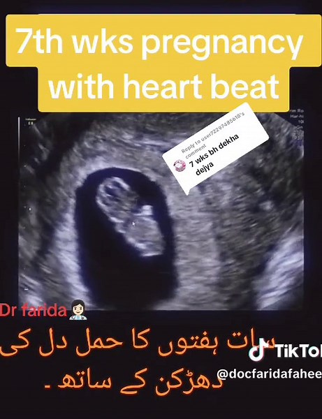 Replying to @user72297485618 #7th wk pregnancy with heart beat#ultrasounds
