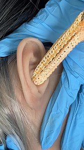 1.4M views · 3.1K reactions | Strange material removed from ear This original video was produced by Rick Lax and Alex Z. | Silly Skits & Sentimental Scenes | Facebook