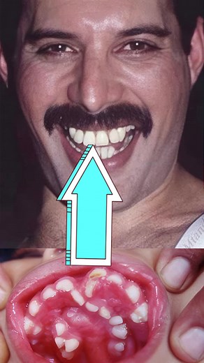 Dientes de Freddie Mercury: su impacto en su talento