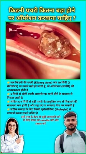 किडनी पथरी कितना बड़ा होने पर ऑपरेशन करवाना चाहिए ? Kidney stones treatment process || #viral