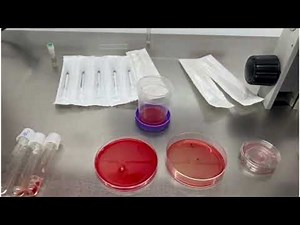 OOCYTE SCANNING IN IVF