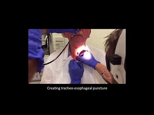 Secondary tracheo-esophageal puncture, voice prosthesis placement
