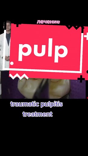 Treatment of Traumatic Pulpitis: Dental Care Insights