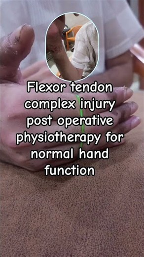 🖐️ Flexor Tendon Injury – Post-Operative Physiotherapy