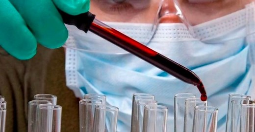 D-dimer testi ile Covid’e bağlı emboli tehlikesi önlenebilir | Sağlık Haberleri