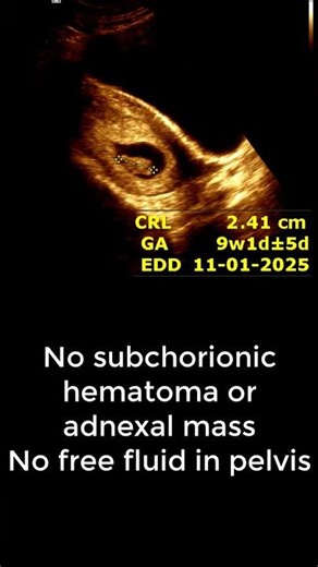 9 Weeks Pregnancy Scan | Fetal Heartbeat Seen | Early Pregnancy Advice