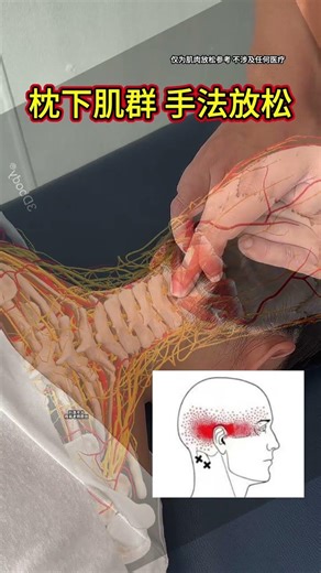 Relaxation techniques for the suboccipital muscle group#How to relieve cervical