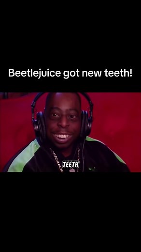 Beetlejuice got new teeth!!! #beetlejuice #beetlejUiceclips #wackpack #howardsternshow #howardstern #siriusxm #ronniethelimodriver #teeth