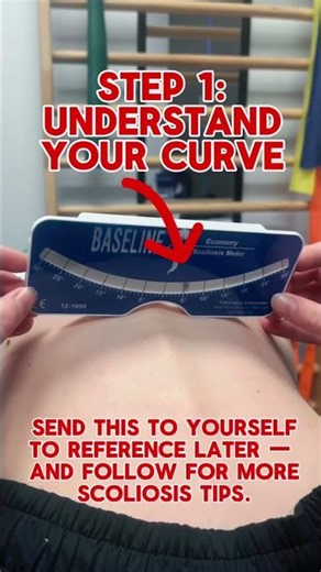 Steps to begin Schroth Exercise for Scoliosis