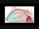 Septoplasty • Video • MEDtube.net