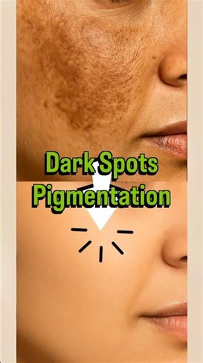 Potato Cream for Dark Spots & Pigmentation 🥔✨ #ashortaday