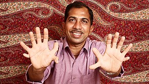 Record Holder Profile Video: Devendra Suthar - the man with the most fingers and toes
