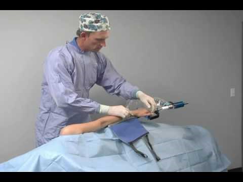SPIDER Lateral Shoulder Procedure | SPIDER Limb Positioner | SIMON MOYES