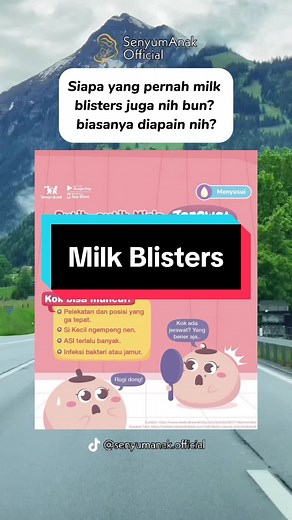 Milk blister, sering juga disebut bleb atau nipple blister, adalah luka lepuh di area puting yang tampak seperti benjolan kecil berisi cairan berwarna putih kekuningan. Penanganan yang bisa dilakukan di rumah : - Kompres hangat daerah puting 2-3 menit sebelum menyusui - Variasikan posisi saat menyusui - Rutin bersihkan area puting dan areola setelah menyusui - Gunakan bra dengan ukuran yang pas - Bila terasa sangat nyeri saat menyusui boleh dibantu dengan kompres dingin setelah menyusui atau ant