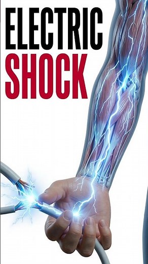 What Happens Inside Your Body When You Get an Electric Shock? ⚡| 3D Medical Animation #shorts.
