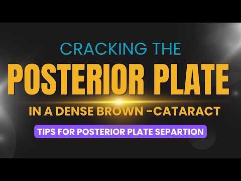 Tips for cracking the posterior plate in dense cataract, "Flip and phaco the base": Dr. Deepak Megur
