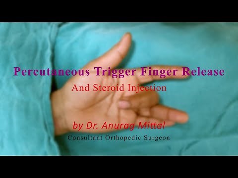 Finger stuck in "bent" position? Percutaneous (scarless) trigger finger release