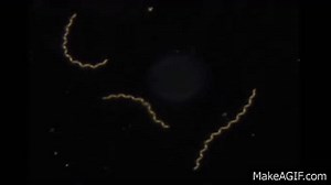 Treponema pallidum on Make a GIF