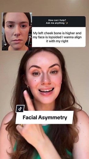 Tips for Correcting Facial Asymmetry Naturally