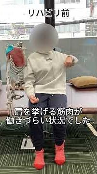 脳梗塞/50代女性｜“左手を動かしたい・装具なしで歩きたい”左片麻痺の上肢・歩行改善事例 #脳梗塞 #くも膜下出血 #左片麻痺 #上肢リハビリ #歩行改善 #自費リハビリ #脳神経リハビリセンター