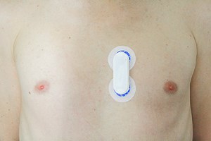 Blinking LEDs! What else ECG is good for? | Details | Hackaday.io