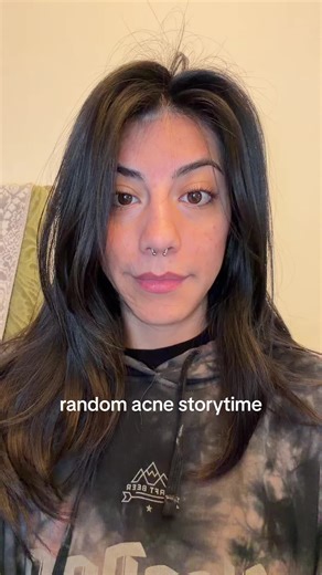 My Acne Journey: From Struggles to Skincare Solutions