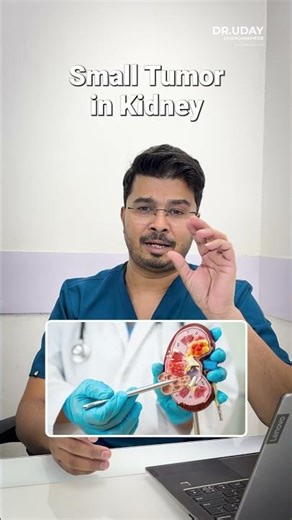 Kidney Mass in CT Scan or Ultrasound? Early Kidney Cancer Signs Explained