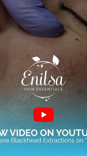 Enilsa Brown on Instagram: "Hello my sweet Facebook friends! 💕 This is my latest video of K. His skin is responding great to his treatment plan. Head to my Youtube channel to watch the full video! 💕 https://youtu.be/U7hMedOMOR8 Hugs & Blessings, Enilsa & Team"