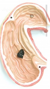 208K views · 828 reactions | È simile a Venom e a Flubber, questo robot gelatinoso potrebbe essere una vera svolta per le operazioni gastrointestinali. | Ohga | Facebook