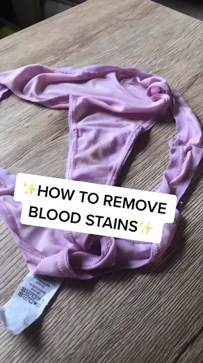 How to Remove Blood Stains: Tips and Tricks