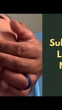 Lymph node: Submental-Where is it? What Does Swelling Mean?