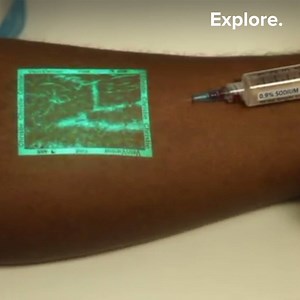 A system that enables real-time display of the superficial venous network. | Explore - The Best of Innovation