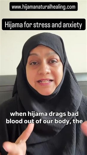 Hijama for stress and anxiety