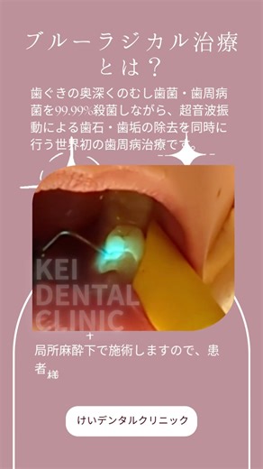 毎日ブルーラジカル！⑮