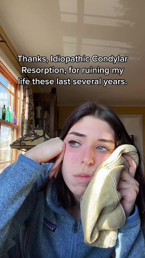 Understanding ICR: A Guide to Idiopathic Condylar Resorption