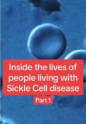 Part 1 - Inside the lives of people living with Sickle Cell disease