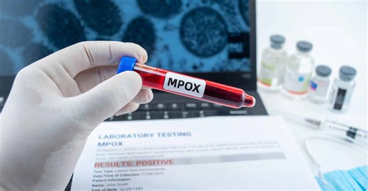 Mpox in the Middle East: How to diminish the risk?