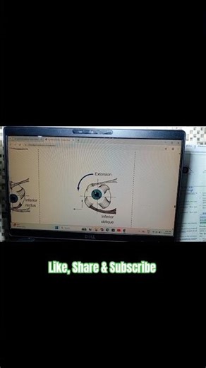 Eye Movements | Actions of Extraocular Muscles | ‎⁨@Medical-medics⁩ #ophthalmology #eyes