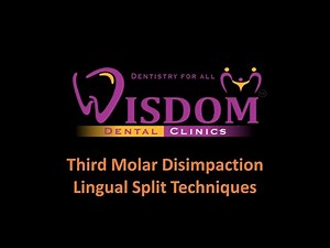 Third Molar Dis-impaction - Lingual Split Technique @ Wisdom Dental Clinics