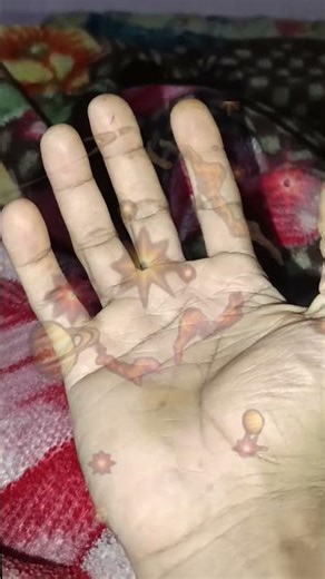 Bhai Ye Kya Ho Raha Hai?