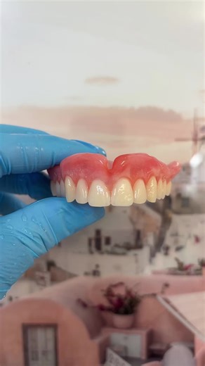 Full Upper BPS Denture ready for insert! #bondent #dentures #bps #smile