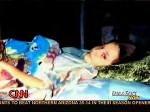 CNN report on Reflex Sympathetic Dystrophy