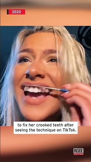 Don't Use a Nail File on Your Teeth #shorts