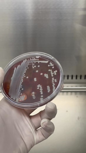 142K views · 893 reactions | Bạn có biết vì sao Staphylococcus lugdunensis dễ nhầm với Staphylococcus aureus không? Cùng thử trả lời xem đúng không nhé! #microbiology #labinsight #sinhvienyduoc #kythuatxetnghiem #NuoiCay #lablife #visinh #staphylococcus | Xét Nghiệm Y Học | Facebook