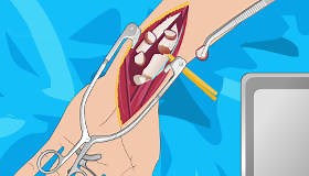 Operate Now Arm Surgery